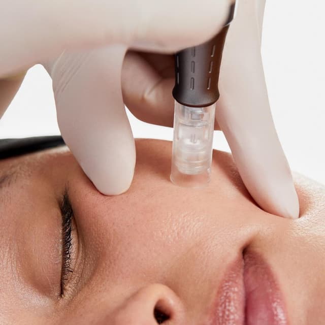 Microneedling Series at Brittney Murphy Skincare in Windsor, CO